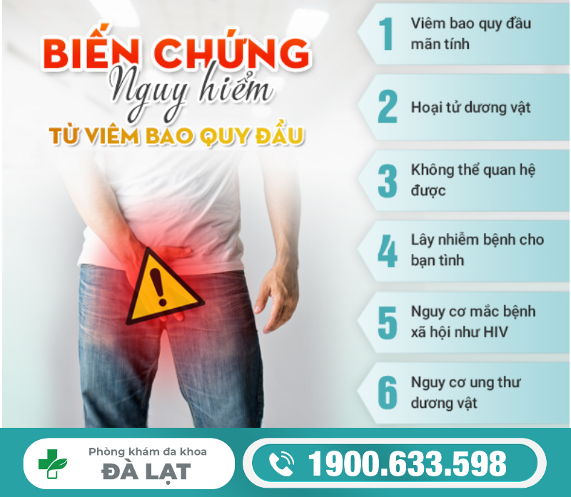 Hình ảnh minh họa